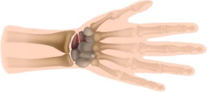 Fractured Scaphoid healing time guide